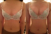 素早く育乳したい人は【戸瀬恭子施術】バストドレナージュ