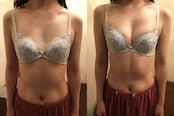 育乳カウンセリング〔DVD付き）