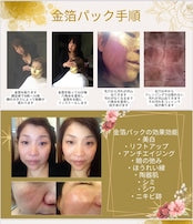 【ウインターキャンペーン】施術ガチャ