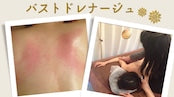 【ウインターキャンペーン】施術ガチャ