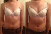 素早く育乳したい人は【戸瀬恭子施術】バストドレナージュ